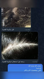 مجموعة العناية الكاملة بالشعر | Complete Hair Care Bundle