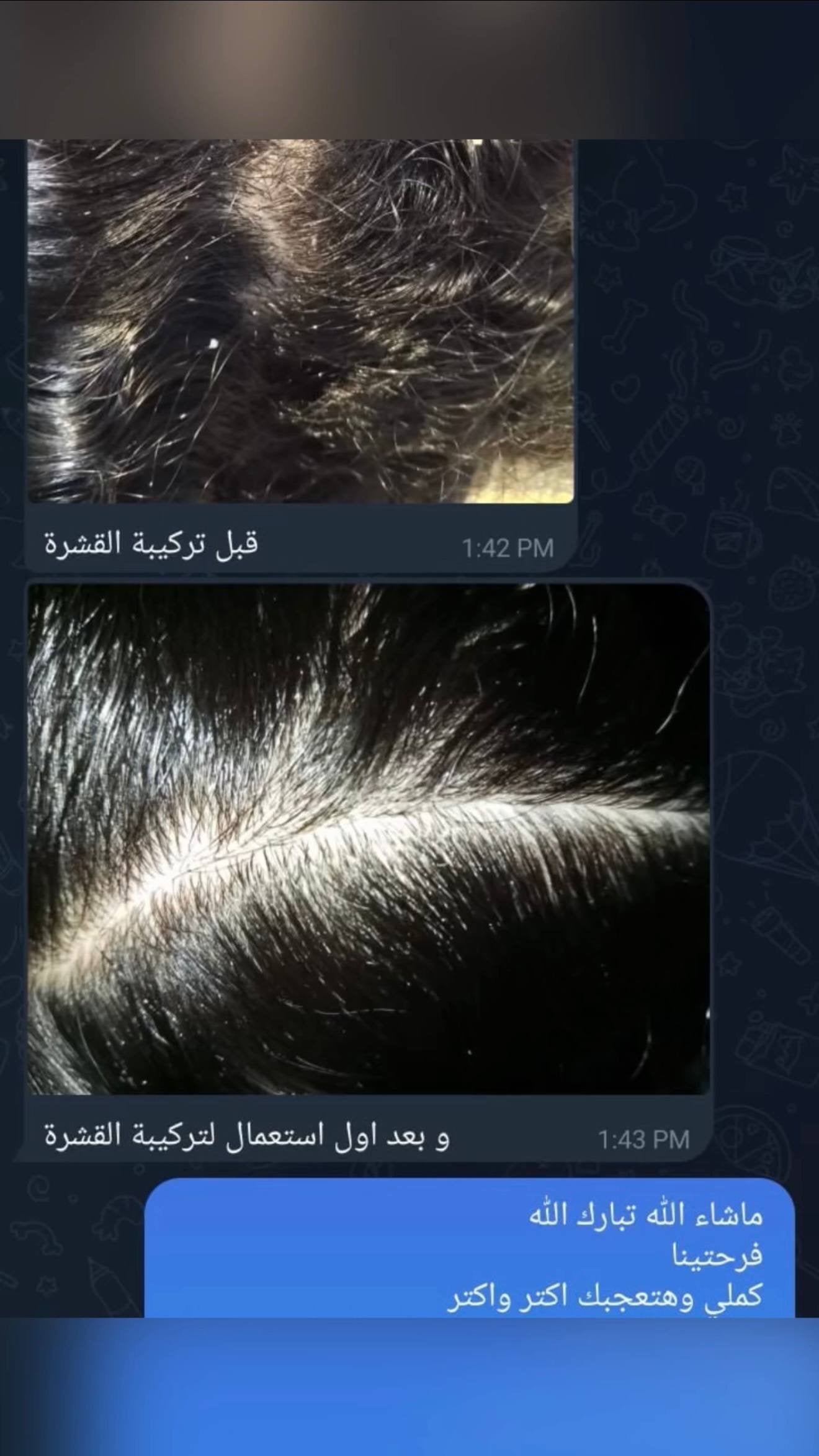 مجموعة العناية الكاملة بالشعر | Complete Hair Care Bundle
