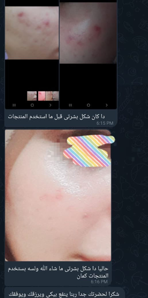 Gold Acne Kit | مجموعة الحبوب المتقدمة