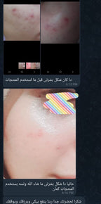 Gold Acne Kit | مجموعة الحبوب المتقدمة